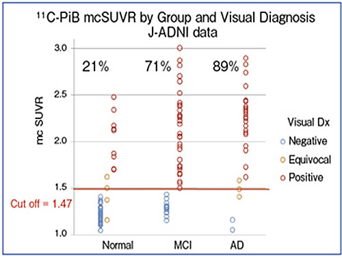 図2　11C-PIB-PETの視覚的読影結果（J-ADNIデータより）