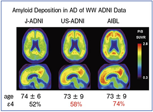 図３　J-ADNI、US-ADNI、AIBLにおけるAD患者のアミロイドPETの平均画像