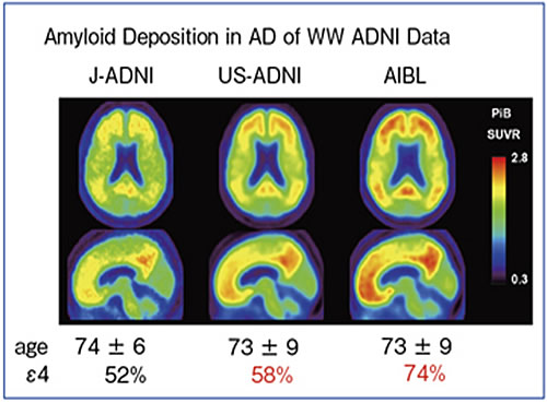 図3 J-ADNI、US-ADNI、AIBLにおけるAD患者のアミロイドPETの平均画像